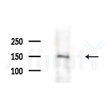 Gli3 Antibody - Western blot analysis of extracts from Rat brain, using Gli3 Antibody at 1/1000 dilution.