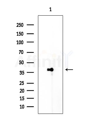 KR2_EBV Antibody - Western blot analysis of extracts from HUVEC cells, using KR2_EBV Antibody at 1/1000 dilution.