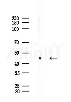 KR2_EBV Antibody - Western blot analysis of lysates from EC304 cells, using KR2_EBV Antibody at 1/1000 dilution.