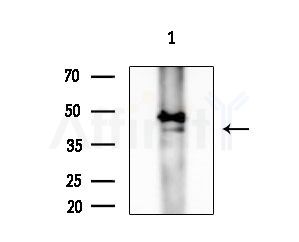KITH_VZV7 Antibody - Western blot analysis of extracts from 293 cells(starvation treatment), using KITH_VZV7 Antibody at 1/1000 dilution.