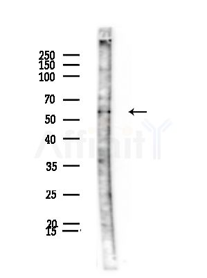 PPP2R1A Antibody - Western blot analysis of lysates from Hela cells(heat-shock,45min treatment), using PPP2R1A Antibody at 1/1000 dilution.