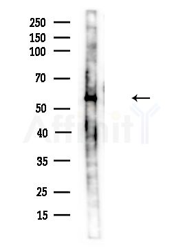 PPP2R1A Antibody - Western blot analysis of lysates from Mouse brain, using PPP2R1A Antibody at 1/1000 dilution.