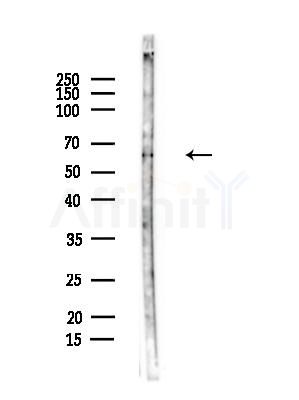 PPP2R1A Antibody - Western blot analysis of lysates from Hela cells(heat-shock,45min treatment), using PPP2R1A Antibody at 1/1000 dilution.