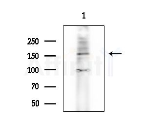 NKTR Antibody - Western blot analysis of extracts from A549 cells(heat-shock treatment), using NKTR Antibody at 1/1000 dilution.