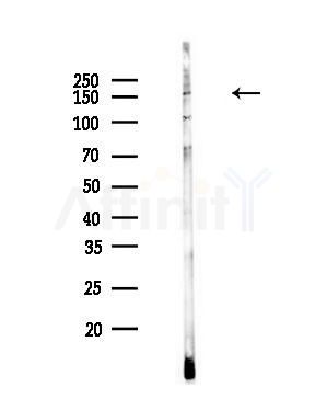 NKTR Antibody - Western blot analysis of lysates from A549 cells(heat-shock,45min treatment), using NKTR Antibody at 1/1000 dilution.