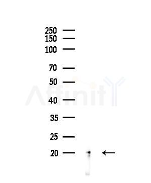 CD52 Antibody - Western blot analysis of lysates from MDA-MB-231 cells, using CD52 Antibody at 1/1000 dilution.