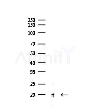 CD52 Antibody - Western blot analysis of lysates from RAW264.