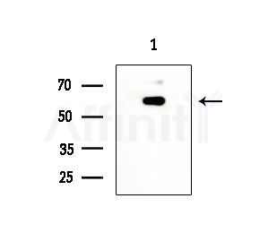 GCVK_HHV7J Antibody - Western blot analysis of extracts from Mouse liver, using GCVK_HHV7J Antibody at 1/1000 dilution.