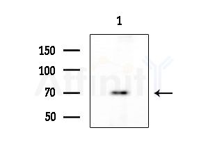 GCVK_HHV7J Antibody - Western blot analysis of extracts from HUVEC cells, using GCVK_HHV7J Antibody at 1/1000 dilution.
