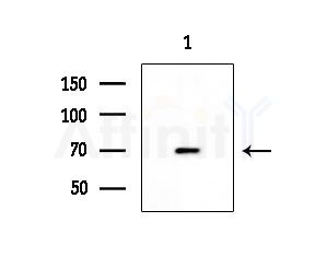 GCVK_HHV7J Antibody - Western blot analysis of extracts from EC304 cells, using GCVK_HHV7J Antibody at 1/1000 dilution.