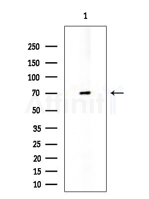 GCVK_HHV7J Antibody - Western blot analysis of extracts from Rat testis, using GCVK_HHV7J Antibody at 1/1000 dilution.