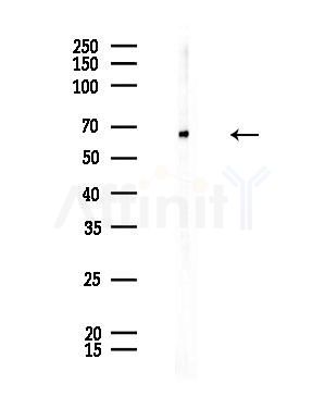 GCVK_HHV7J Antibody - Western blot analysis of lysates from Rat testis, using GCVK_HHV7J Antibody at 1/1000 dilution.