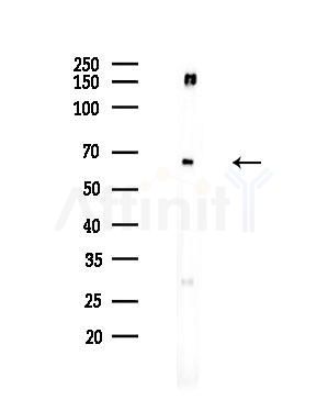 GCVK_HHV7J Antibody - Western blot analysis of lysates from EC304 cells, using GCVK_HHV7J Antibody at 1/1000 dilution.