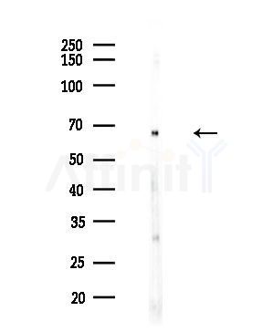 GCVK_HHV7J Antibody - Western blot analysis of lysates from HUVEC cells, using GCVK_HHV7J Antibody at 1/1000 dilution.