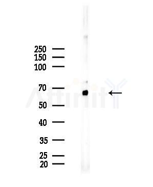 GCVK_HHV7J Antibody - Western blot analysis of lysates from Mouse liver, using GCVK_HHV7J Antibody at 1/1000 dilution.