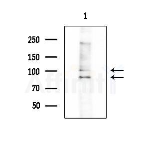 ENTK Antibody - Western blot analysis of extracts from HepG2 cells(LPS 4h treatment), using ENTK Antibody at 1/1000 dilution.