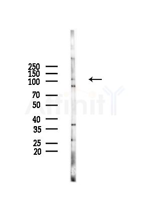 ENTK Antibody - Western blot analysis of lysates from HepG2 cells(LPS,4h treatment), using ENTK Antibody at 1/1000 dilution.