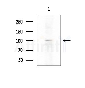 Basonuclin Antibody - Western blot analysis of extracts from HepG2 cells(LPS 4h treatment), using Basonuclin Antibody at 1/1000 dilution.