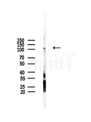 Basonuclin Antibody - Western blot analysis of lysates from HepG2 cells(LPS,4h treatment), using Basonuclin Antibody at 1/1000 dilution.