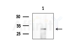 EMX2 Antibody - Western blot analysis of extracts from EC304 cells, using EMX2 Antibody at 1/1000 dilution.