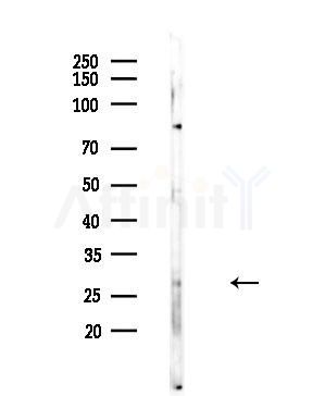 EMX2 Antibody - Western blot analysis of lysates from EC304 cells, using EMX2 Antibody at 1/1000 dilution.