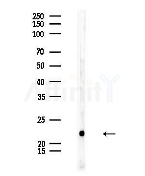 TAF10 Antibody - Western blot analysis of lysates from Rat testis, using TAF10 Antibody at 1/1000 dilution.