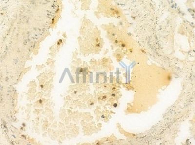 AKAP6 Antibody - DF8820 at 1/100 staining human normal placenta tissue by IHC-P.