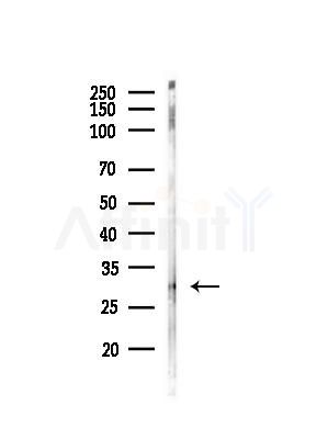 FHL3 Antibody - Western blot analysis of lysates from EC304 cells(heat-shock,45min treatment), using FHL3 Antibody at 1/1000 dilution.