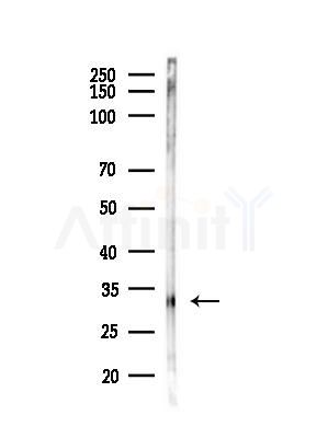 FHL3 Antibody - Western blot analysis of lysates from PC12 cells(LPS, 4h treatment), using FHL3 Antibody at 1/1000 dilution.