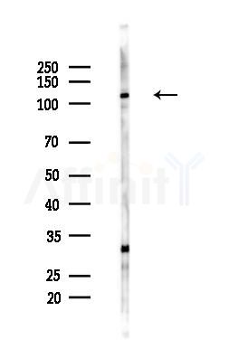 SART3 Antibody - Western blot analysis of lysates from Hela cells(heat-shock,45min treatment), using SART3 Antibody at 1/1000 dilution.