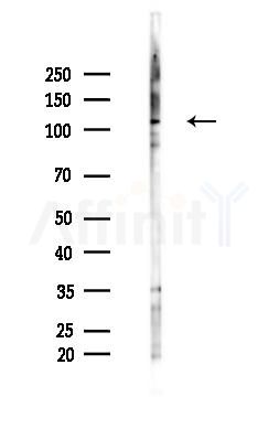 SART3 Antibody - Western blot analysis of lysates from LoVo cells(heat-shock,45min treatment), using SART3 Antibody at 1/1000 dilution.