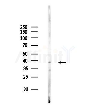 hnRNP E1 Antibody - Western blot analysis of lysates from Rat brain, using hnRNP E1 Antibody at 1/1000 dilution.