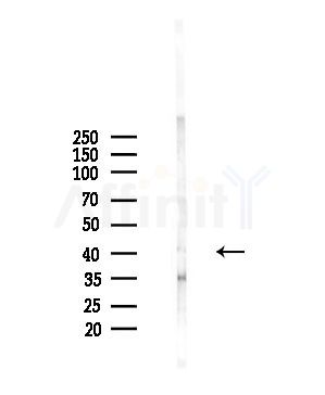 hnRNP E1 Antibody - Western blot analysis of lysates from A375 cells(starvation,24h treatment), using hnRNP E1 Antibody at 1/1000 dilution.