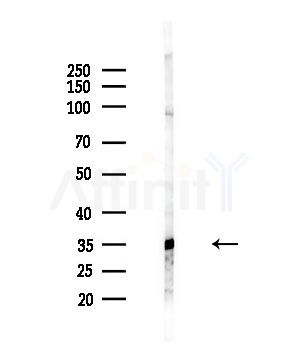 hnRNP E1 Antibody - Western blot analysis of lysates from HepG2 cells(LPS,4h treatment), using hnRNP E1 Antibody at 1/1000 dilution.
