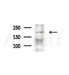 LRRK1 Antibody - Western blot analysis of extracts from B16F10-LUC cells(heat-shock,45min treatment), using LRRK1 Antibody at 1/1000 dilution.