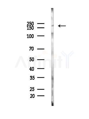 LRRK1 Antibody - Western blot analysis of lysates from B16F10-LUC cells(heat-shock,45min treatment), using LRRK1 Antibody at 1/1000 dilution.