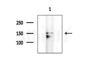 LMTK1 Antibody - Western blot analysis of extracts from HepG2 cells(LPS 4h treatment), using LMTK1 Antibody at 1/1000 dilution.