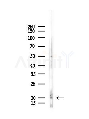 TNFAIP8L1 Antibody - Western blot analysis of lysates from Rat lung, using TNFAIP8L1 Antibody at 1/1000 dilution.