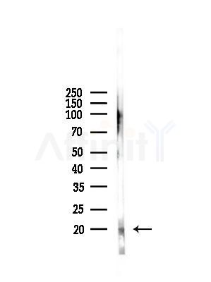 TNFAIP8L1 Antibody - Western blot analysis of lysates from Mouse spleen, using TNFAIP8L1 Antibody at 1/1000 dilution.