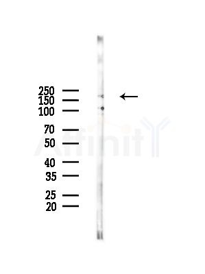 LMO7 Antibody - Western blot analysis of lysates from HepG2 cells(LPS,4h treatment), using LMO7 Antibody at 1/1000 dilution.