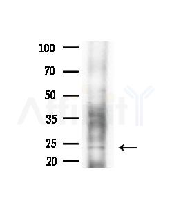 Histone H1X Antibody - Western blot analysis of extracts from Rat brain, using Histone H1X Antibody at 1/1000 dilution.