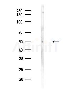 GTF2H4 Antibody - Western blot analysis of lysates from HUVEC cells, using GTF2H4 Antibody at 1/1000 dilution.