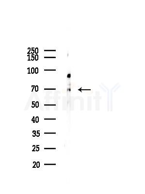 ZNF496 Antibody - Western blot analysis of lysates from COLO205 cells(UV,30min treatment), using ZNF496 Antibody at 1/1000 dilution.