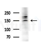 PCDH-X/Y Antibody - Western blot analysis of extracts from HepG2 cells(heat-shock treatment), using PCDH-X/Y Antibody at 1/1000 dilution.