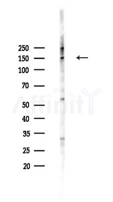 PCDH-X/Y Antibody - Western blot analysis of lysates from HepG2 cells(heat-shock,45min treatment), using PCDH-X/Y Antibody at 1/1000 dilution.
