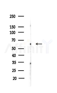 SMG9 Antibody - Western blot analysis of lysates from COLO205 cells(heat-shock,45min treatment), using SMG9 Antibody at 1/1000 dilution.