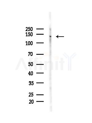 Ubinuclein Antibody - Western blot analysis of lysates from Mouse brain, using Ubinuclein Antibody at 1/1000 dilution.
