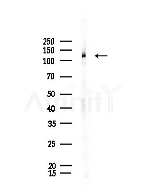 BMP2K Antibody - Western blot analysis of lysates from Rat brain, using BMP2K Antibody at 1/1000 dilution.