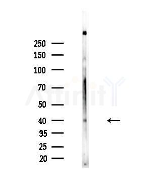 BARHL2 Antibody - Western blot analysis of lysates from EC304 cells, using BARHL2 Antibody at 1/1000 dilution.