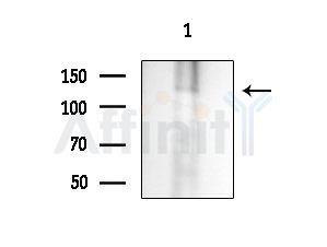 IBTK Antibody - Western blot analysis of extracts from Rat brain, using IBTK Antibody at 1/1000 dilution.